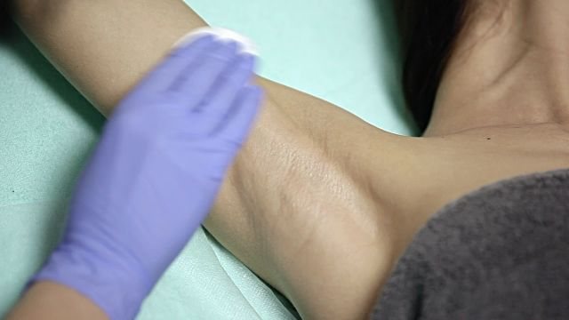 Применение Уротропина от потливости подмышек